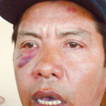 Jesus Antonio Campos Valle, dirigeant du SNTMMSRM à l’usine d’autorails Gunderson, a été brutalement agressé par plusieurs nervis de la CTM