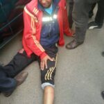 Раненый рабочий