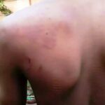 Travailleur montrant les blessures infligées à son dos