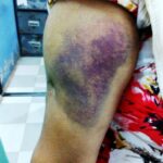 Plus de 50 personnes ont été blessées lors des agressions