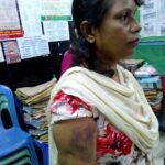 Safiea Parvin, Vice President of the NGWF, was one of those injured.