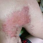 Photo credit: PEPMACO Workers’ Union facebook page