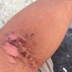 Photo credit: PEPMACO Workers’ Union facebook page